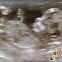 Futuras mamas julio 2016 - 1