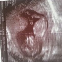 El consultorio de Lita para futuras mamis - 2