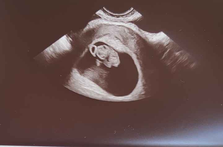 Futuras mamis Enero 2022 - 1
