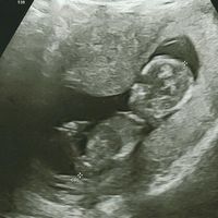 Futuras mamis Enero 2022 - 1