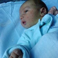 Embarazo y endometriosis - 1