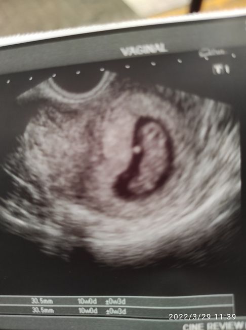 Futuras mamás Octubre 2022 🤰♥️ - 1