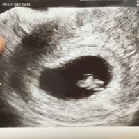 Futuras mamas noviembre 2020 - 1