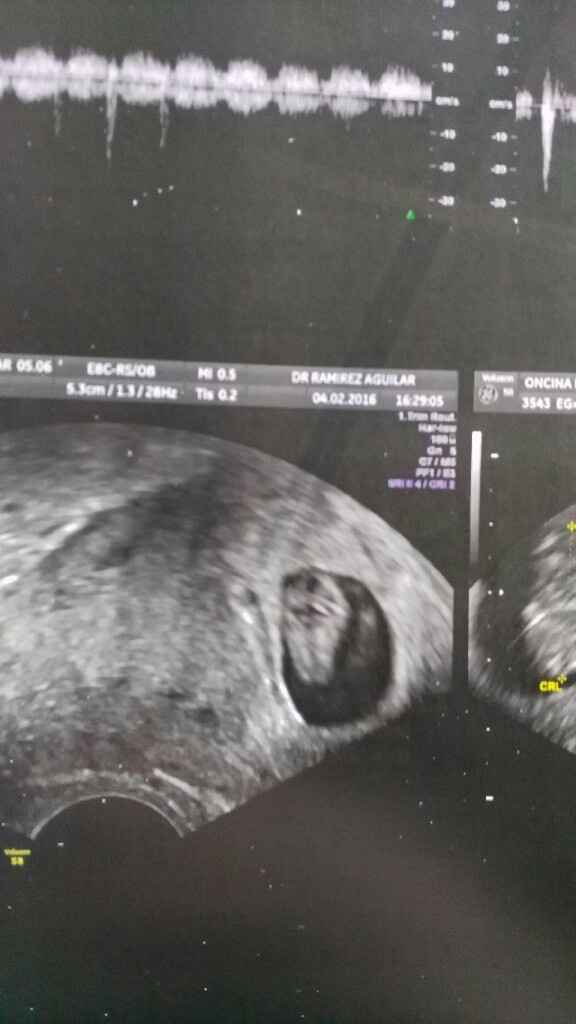 Futuras mamas septiembre 2016 - 1