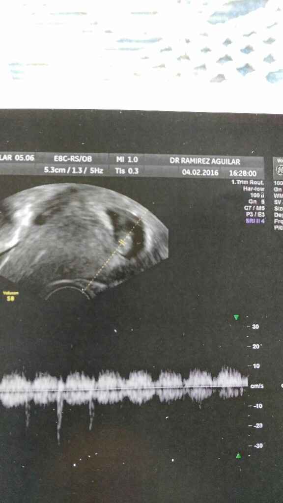 Futuras mamas septiembre 2016 - 2