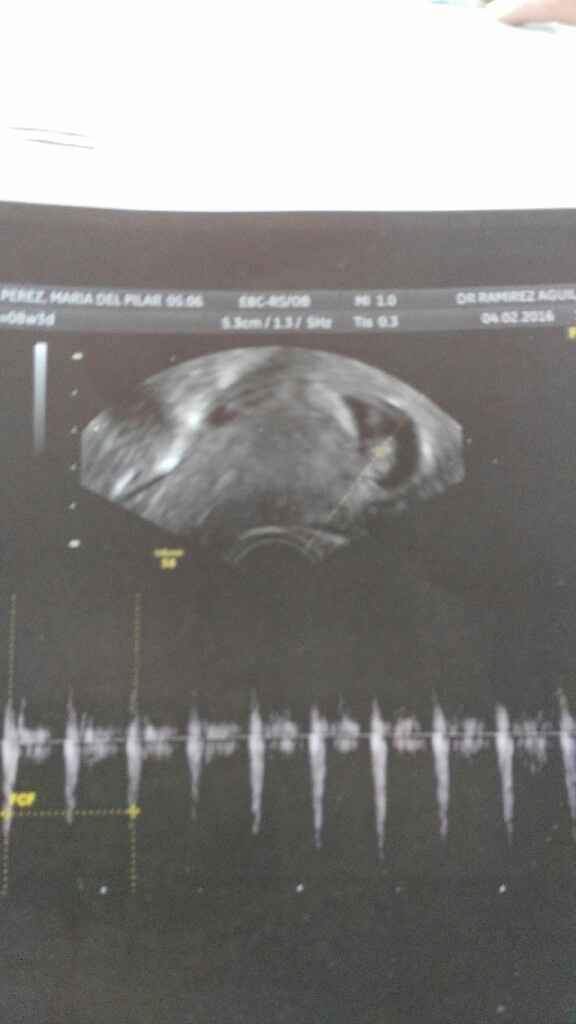 Futuras mamas septiembre 2016 - 3