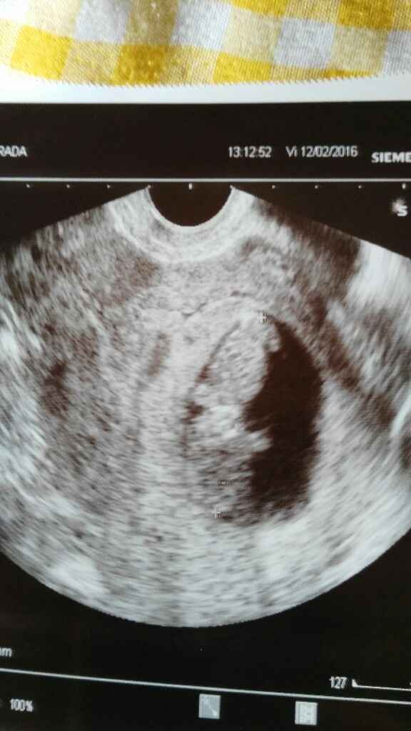 Futuras mamas septiembre 2016 - 1