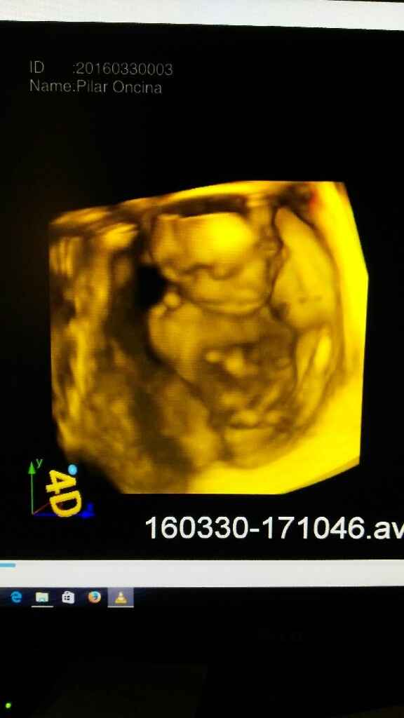 Futuras mamas septiembre 2016 - 1