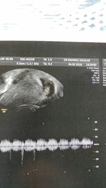 Futuras mamas septiembre 2016 - 2