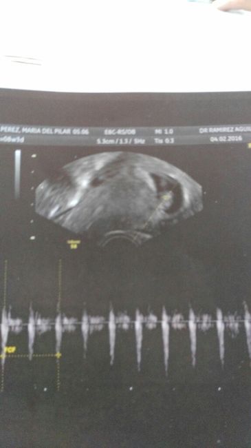 Futuras mamas septiembre 2016 - 3