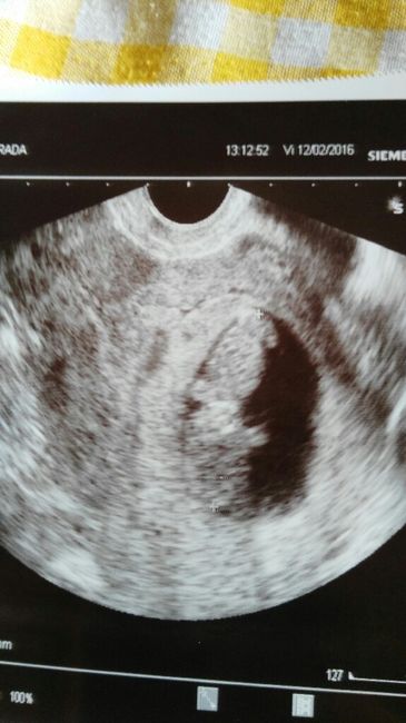 Futuras mamas septiembre 2016 - 1