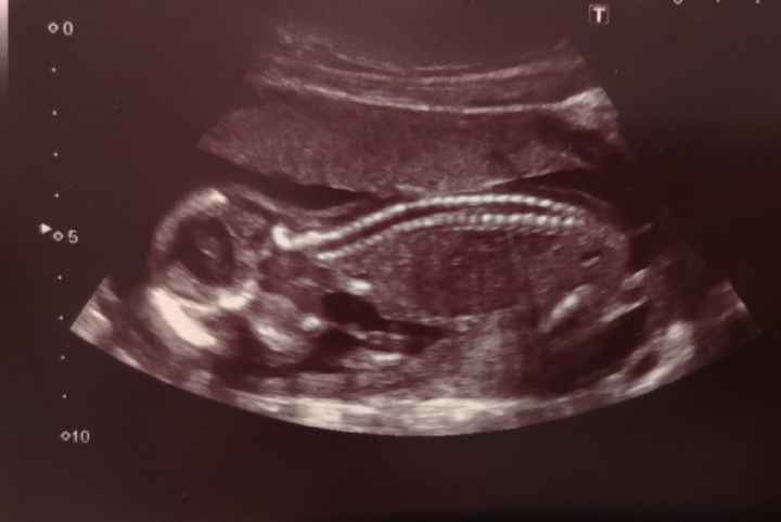 Futuras mamas octubre 2020 - 1