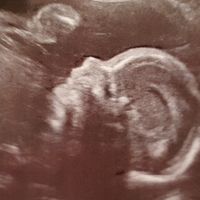 Futuras mamás marzo 2019 - 1