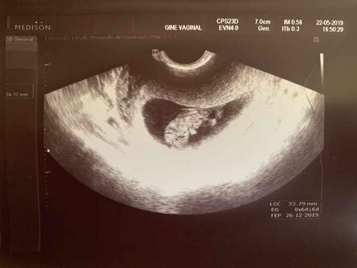 Futuras mamis diciembre 2019 oficial - 1