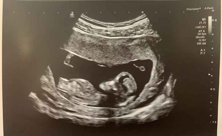 Futuras mamis diciembre 2019 oficial - 2