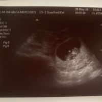 Ayuda con método ramzi: niño o niña? - 2