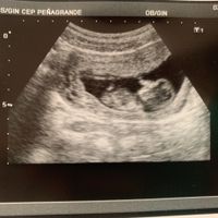 Futuras mamis diciembre 2019 oficial - 1