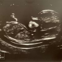 Futuras mamis diciembre 2019 oficial - 1