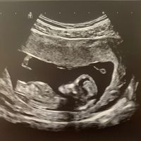 Futuras mamis diciembre 2019 oficial - 2