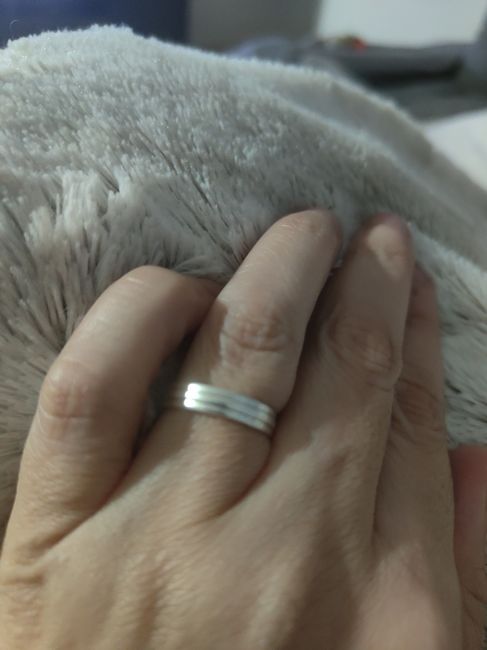 ¿Os parece normal lo de mi anillo? 1