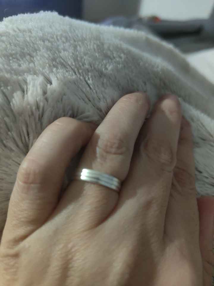 ¿Os parece normal lo de mi anillo? - 1