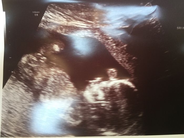 Mamis enero 2016 - 2