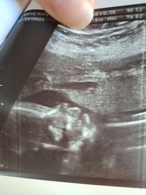 Futuras mamis Febrero 2021 - 1