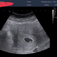 Futuras mamis Junio 2023 - 1