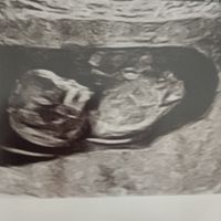 Futuras mamis Junio 2023 - 1