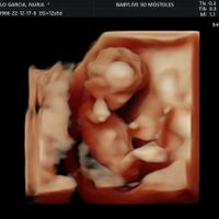 Futuras mamis Junio 2023 - 1