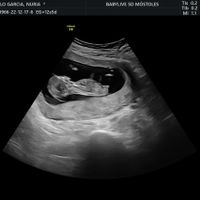 Futuras mamis Junio 2023 - 2