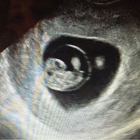 Futuras mamis diciembre 2017 - 2