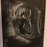 El consultorio de Lita para futuras mamis - 2