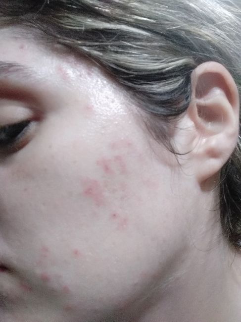 Desastre con la limpieza facial 😭 - 1