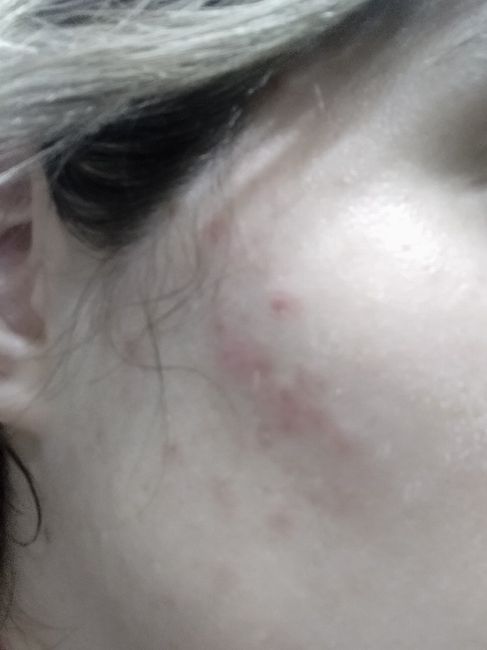Desastre con la limpieza facial 😭 - 2