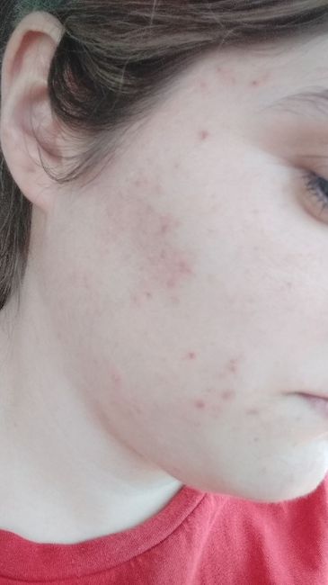 Desastre con la limpieza facial 😭 - 1