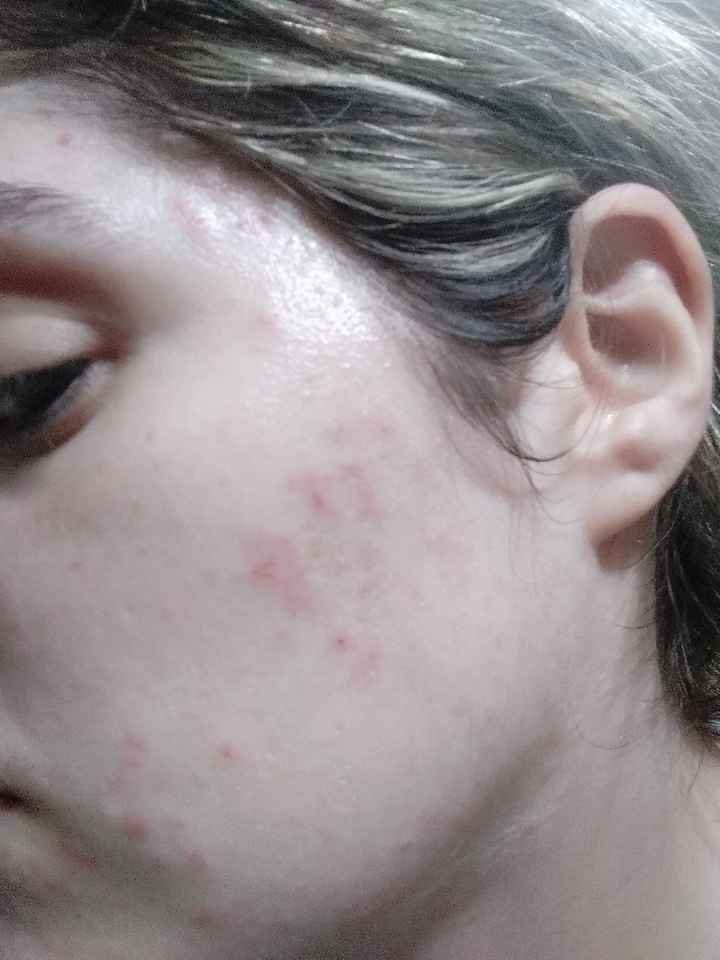 Desastre con la limpieza facial 😭 - 1
