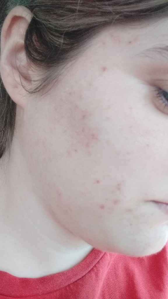 Desastre con la limpieza facial 😭 - 1