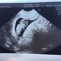 Mamis septiembre 2017 - 1