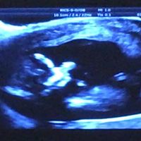 Mamis septiembre 2017 - 1