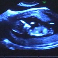 Mamis septiembre 2017 - 2