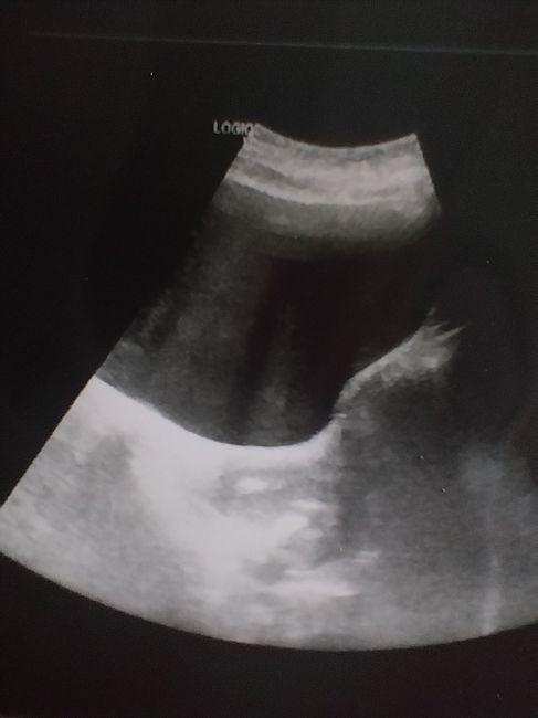 Buscadoras más de 1 año - 2022 - 1