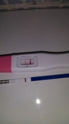 Embarazo y endometriosis 1