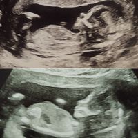 Futuras mamis Junio 2022!! - 1