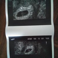 Futuras mamás Noviembre 2018! - 1