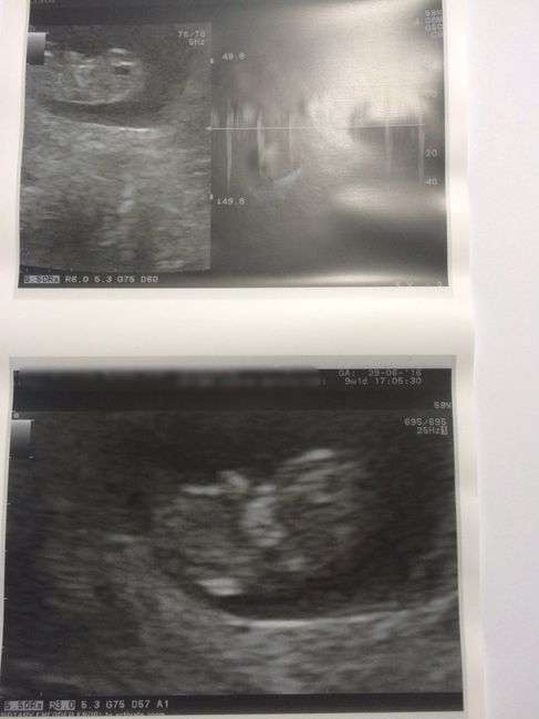 mi bichito de 9 semanas