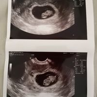 Futuras mamás enero 2019 - 1