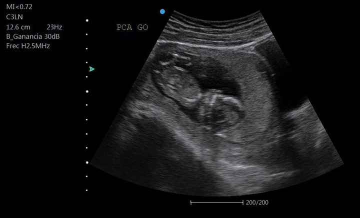 Ayuda! 12.6 semanas... yo creo que es niña 