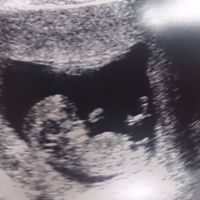 El consultorio de Lita para futuras mamis - 1