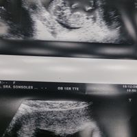 El consultorio de Lita para futuras mamis - 2